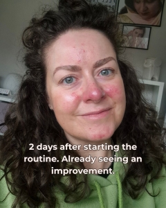 Dr. Sam's skincare - rosacea solution